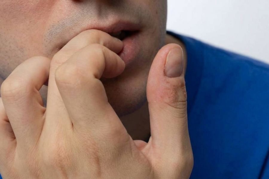 guy biting his fingernails